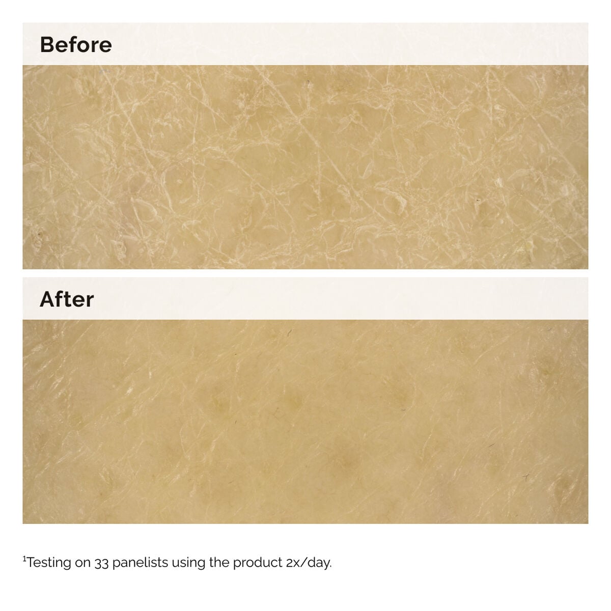 natural-moisturizing-factors-inulin-body-lotion-i7 2024-08-23-ORD-NMF-Inu-BodyB-A-DrynessRadiance-GLOBAL-1x1.jpg