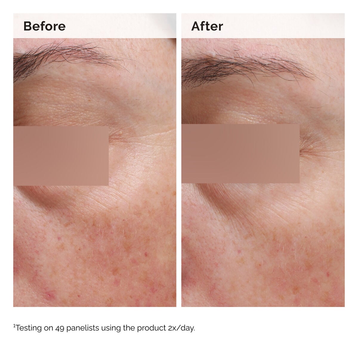 niacinamide-5-face-and-body-emulsion-w6 2024-08-23-ORD-Nia-5pct-Face-Body-B-A-Elasticity-Global-02-1x1.jpg