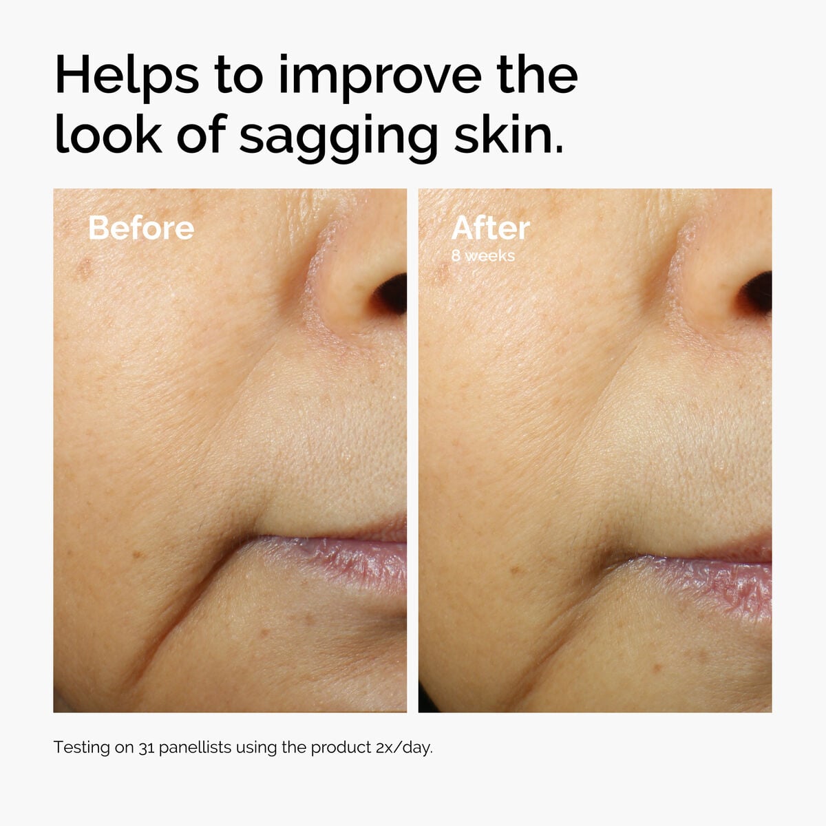 caffeine-3-escin-1-face-serum-v7 ord-caffeine-3pct-escin-1pct-face-serum-before-after-sagging.jpg