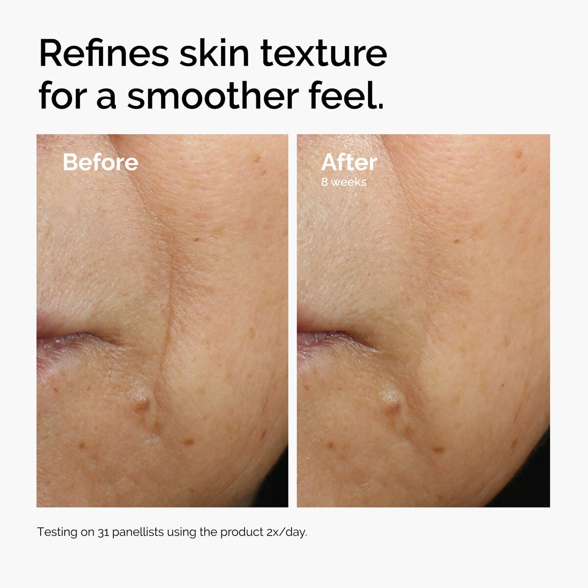 caffeine-3-escin-1-face-serum-v7 ord-caffeine-3pct-escin-1pct-face-serum-before-after-texture.jpg