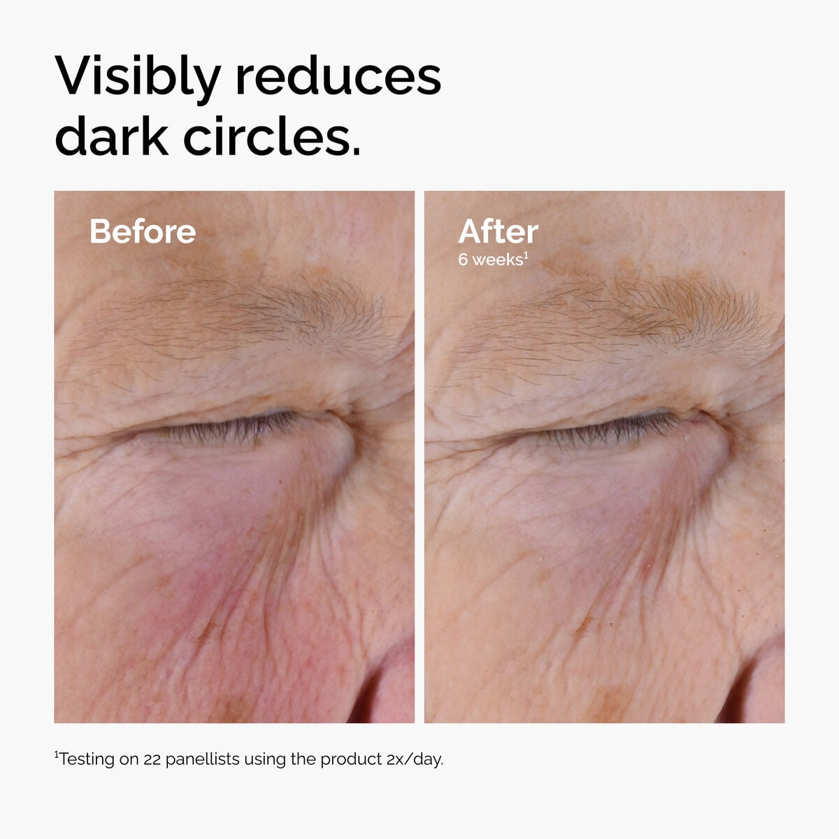 caffeine-solution-5-egcg-eye-serum-s1 ord-caffeine-solution-egcg-dark-circles-before-after.jpg