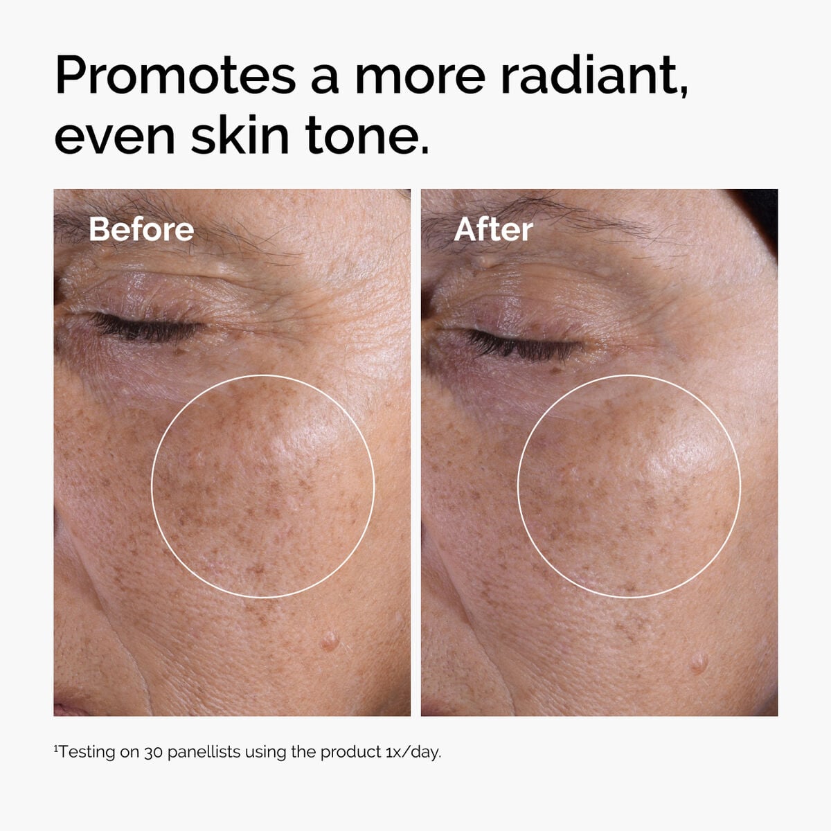 glycolic-acid-7-exfoliating-toner-s7 ord-glycolic-before-after-radiance.jpg