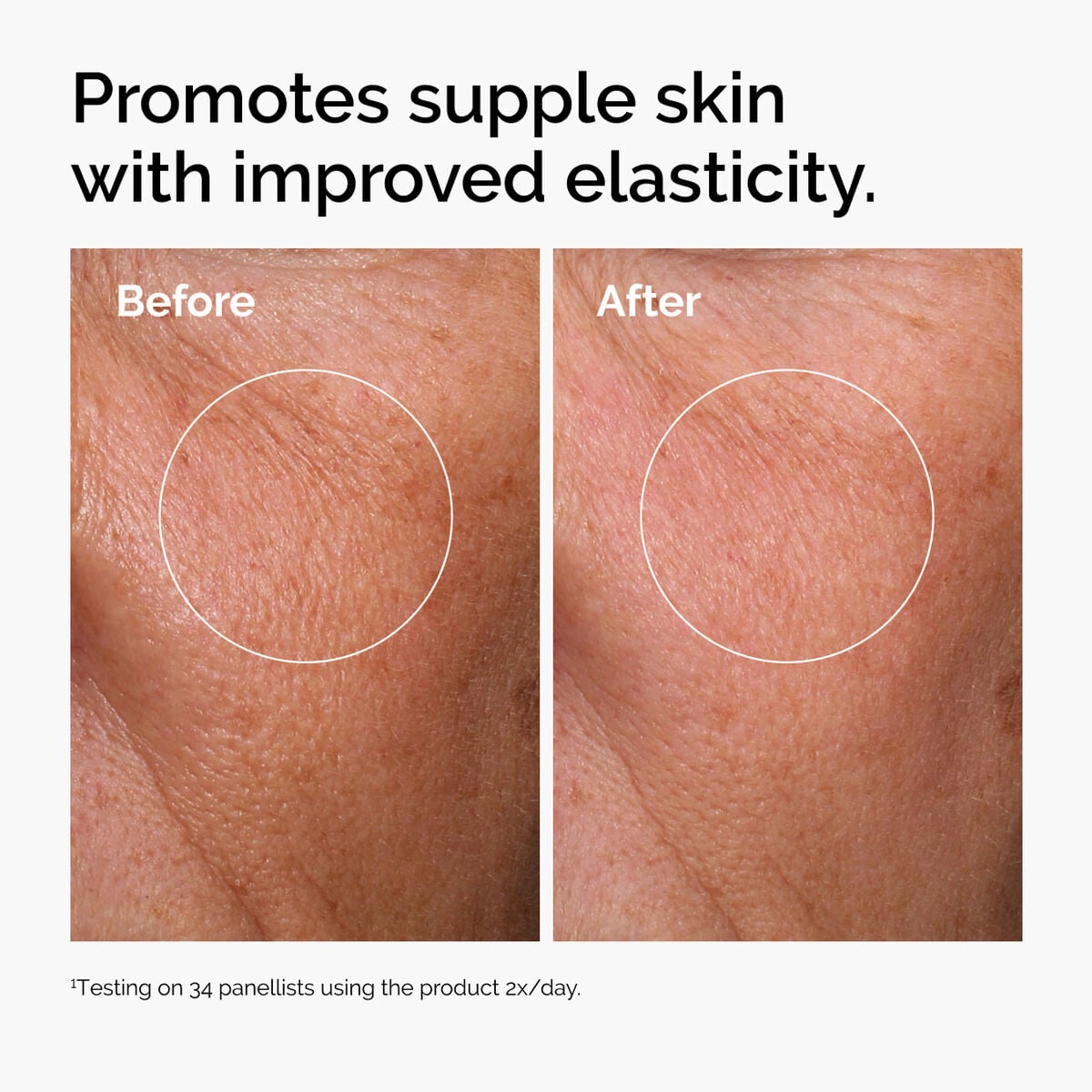 hyaluronic-acid-2-b5-with-ceramides-a1 ord-hyaluronic-acid-2pct-b5-hydrating-serum-before-after-elasticity.jpg