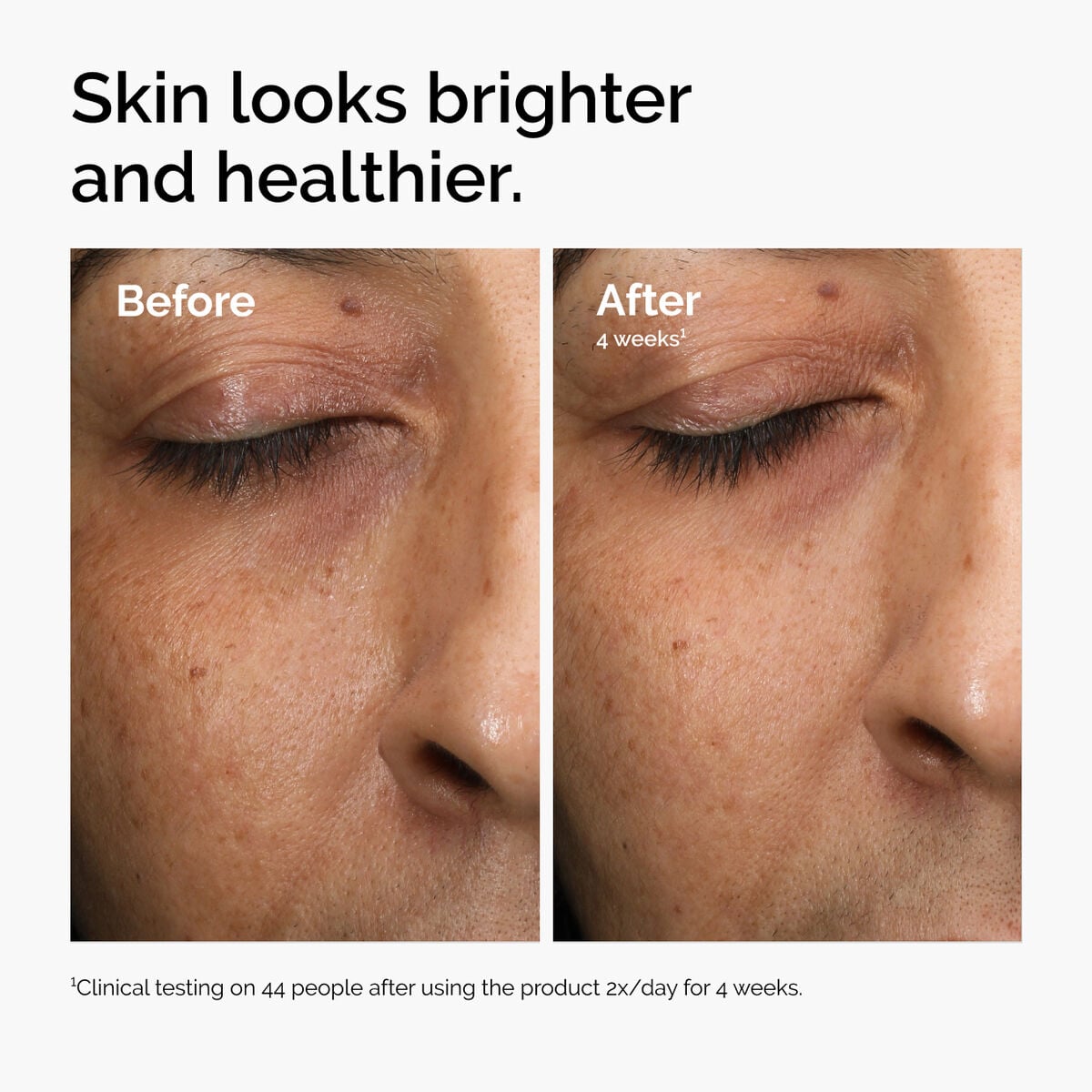 multi-antioxidant-radiance-serum-m3 ord-mars-before-after-healthy.jpg