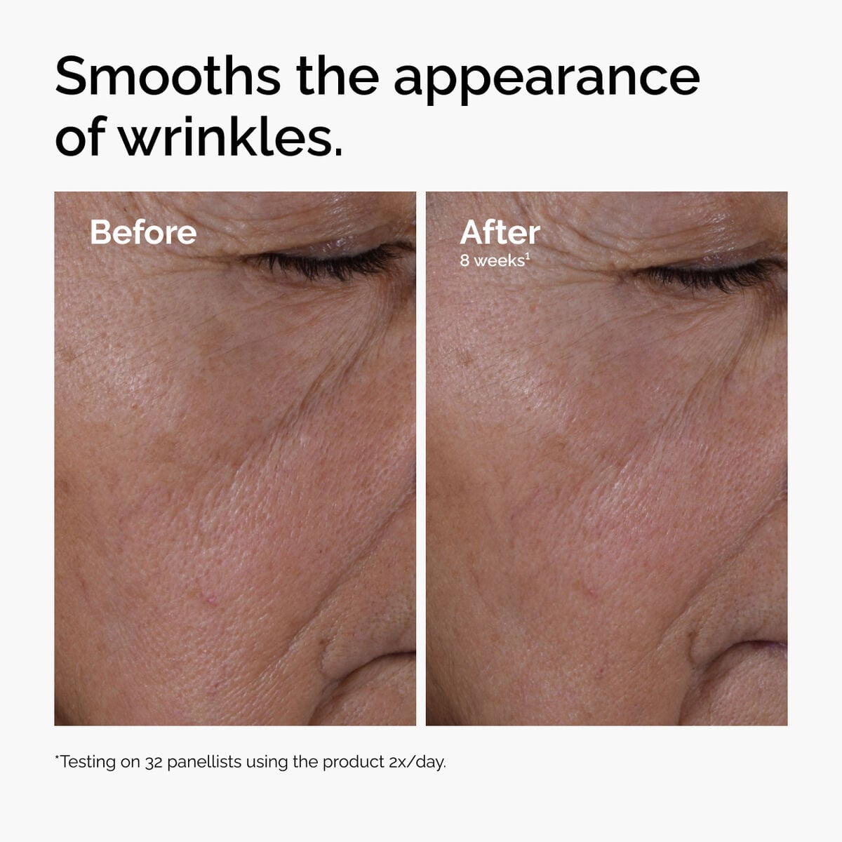 multi-peptide-ha-serum-e0 ord-multi-peptide-ha-serum-wrinkles-before-after.jpg
