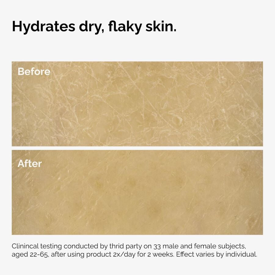the-body-care-collection-w7 ord-natural-moisturizing-factors-inulin-body-before-after-graphic-02.jpg