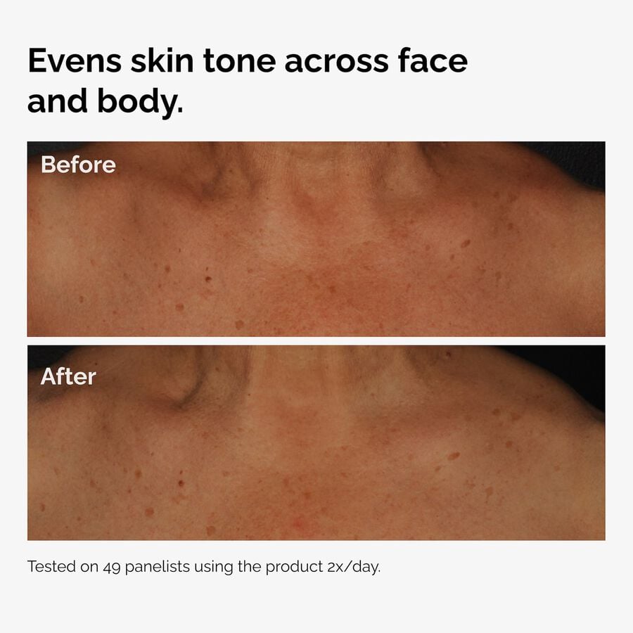 the-body-care-collection-w7 ord-niacinamide-face-body-serum-before-after-even-tone-graphic.jpg