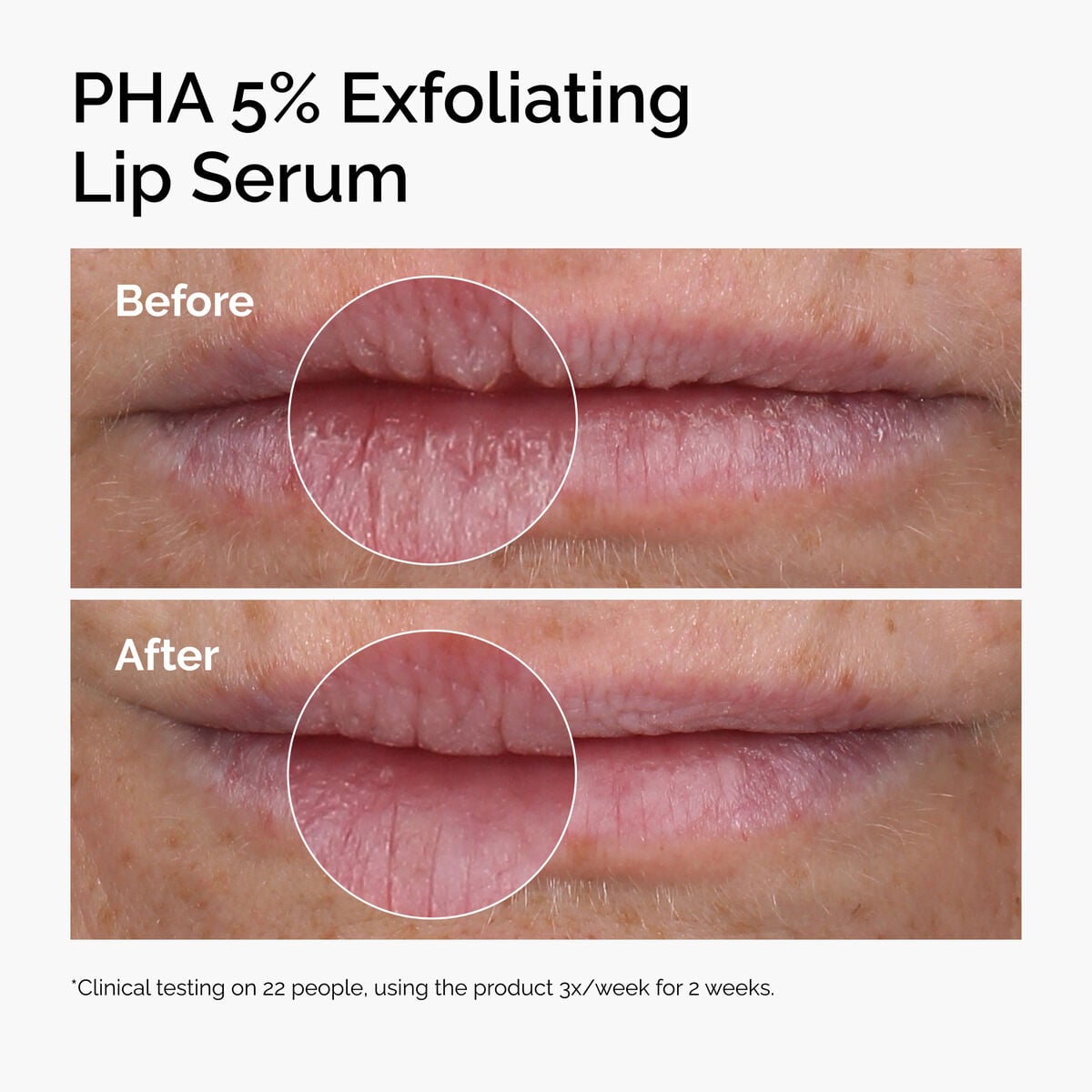 pha-5-exfoliating-lip-serum-t5 ord-pha-5pct-lip-exfoliating-serum-before-after.jpg