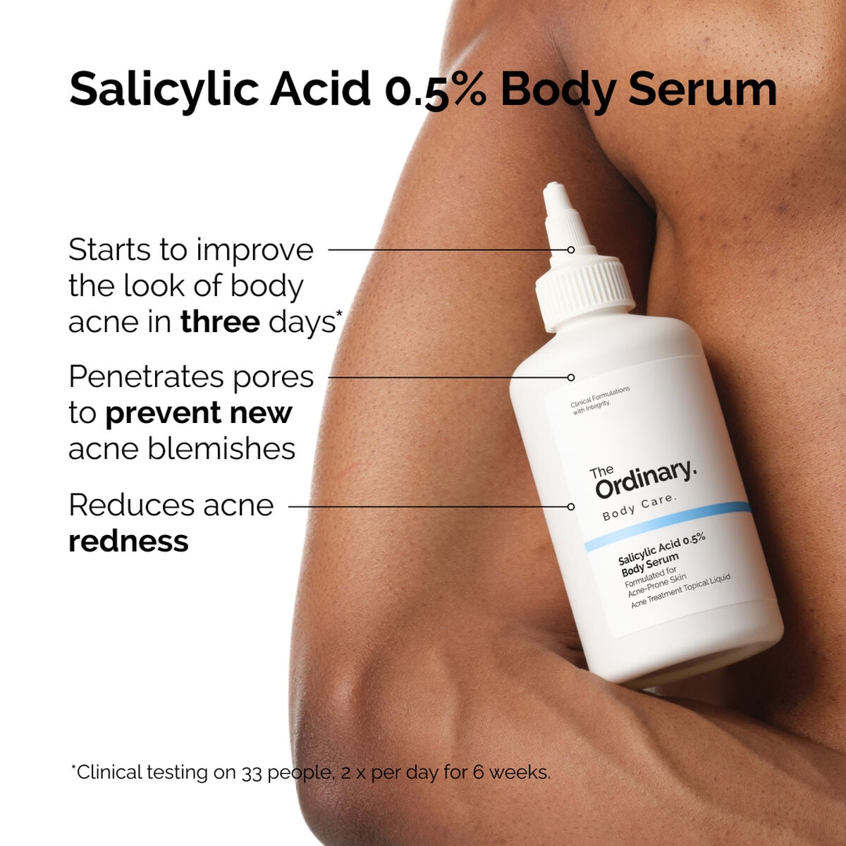 salicylic-acid-0-5-body-serum-v8 ord-salicylic-05-body-serum-otc-benefits-infographic.jpg